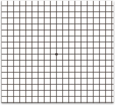 Amsler Grid Test- Retina Ophthalmology Gettysburg PA - Greater Potomac  Retina