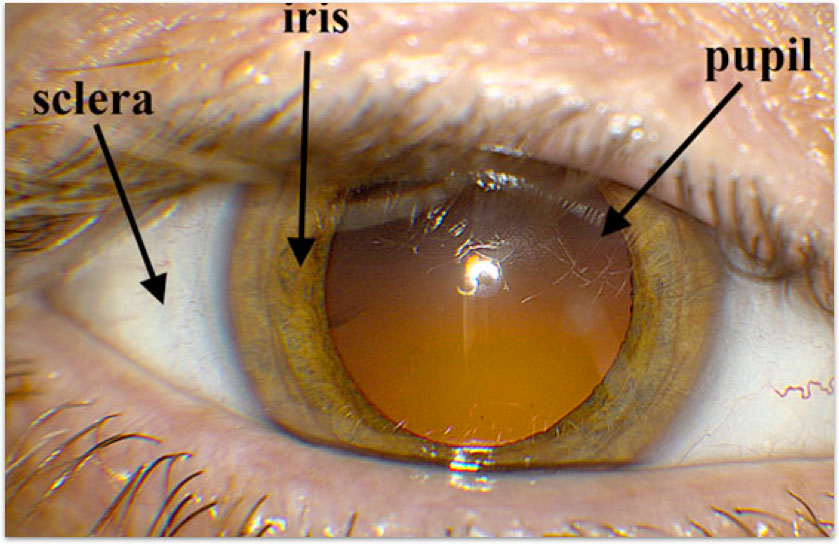 of the Eye - Retina-Vitreous Surgeons of CNY
