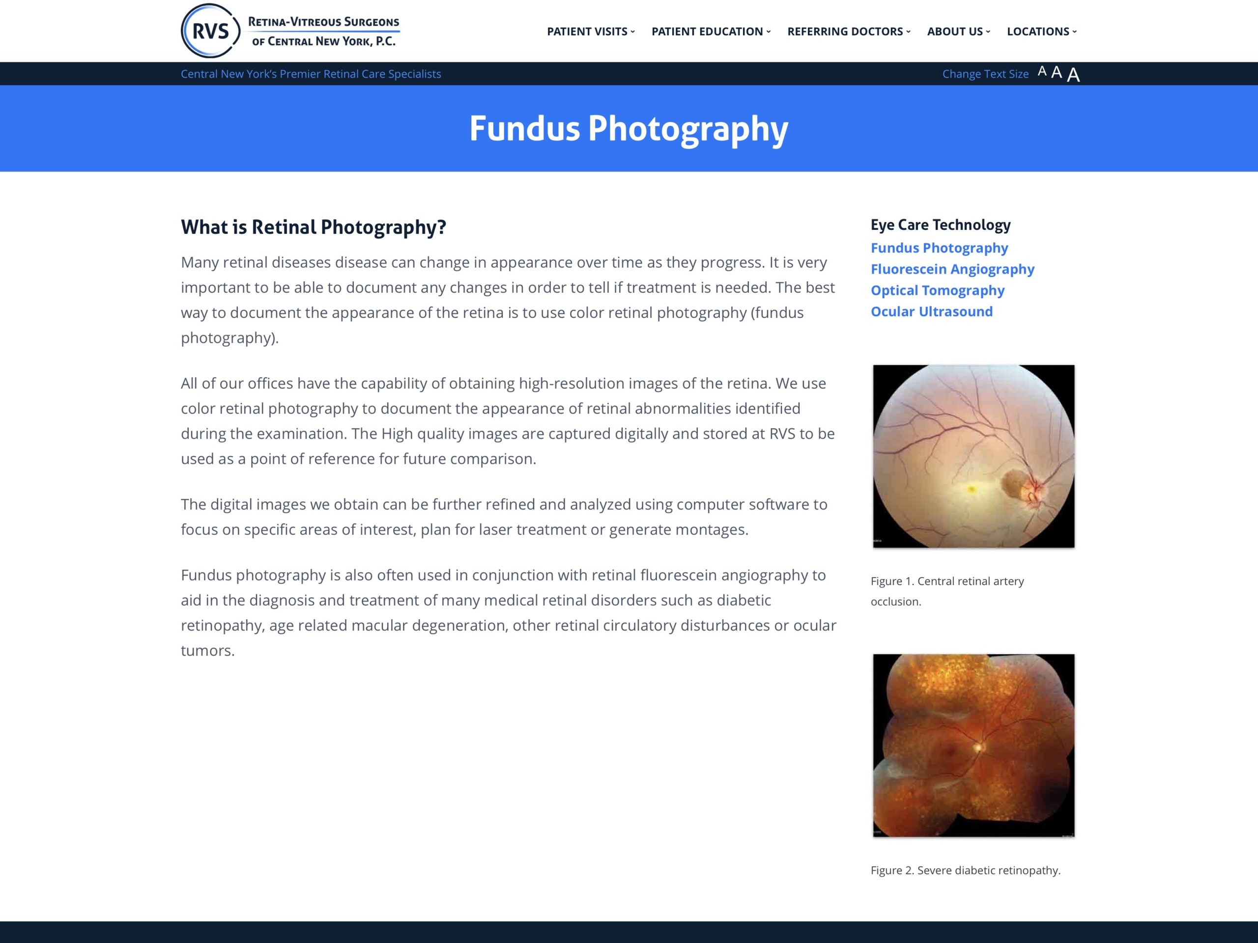 Fundus Photography RetinaVitreous Surgeons of CNY