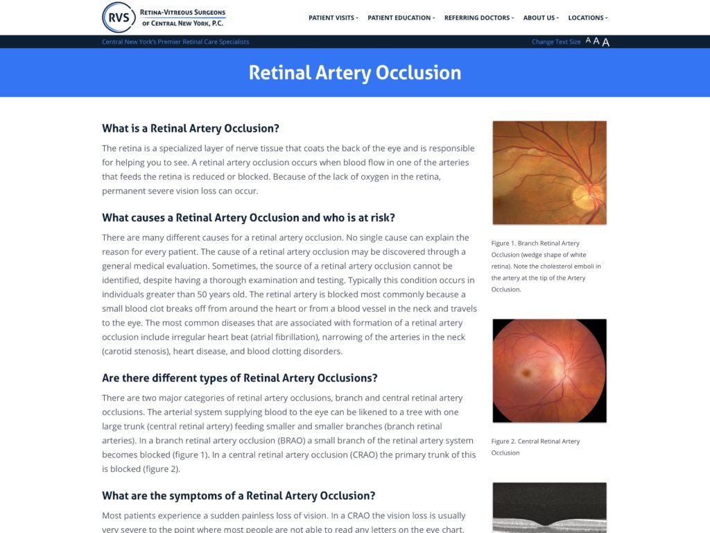 Retinal Artery Occlusion | Retina-Vitreous Surgeons of CNY