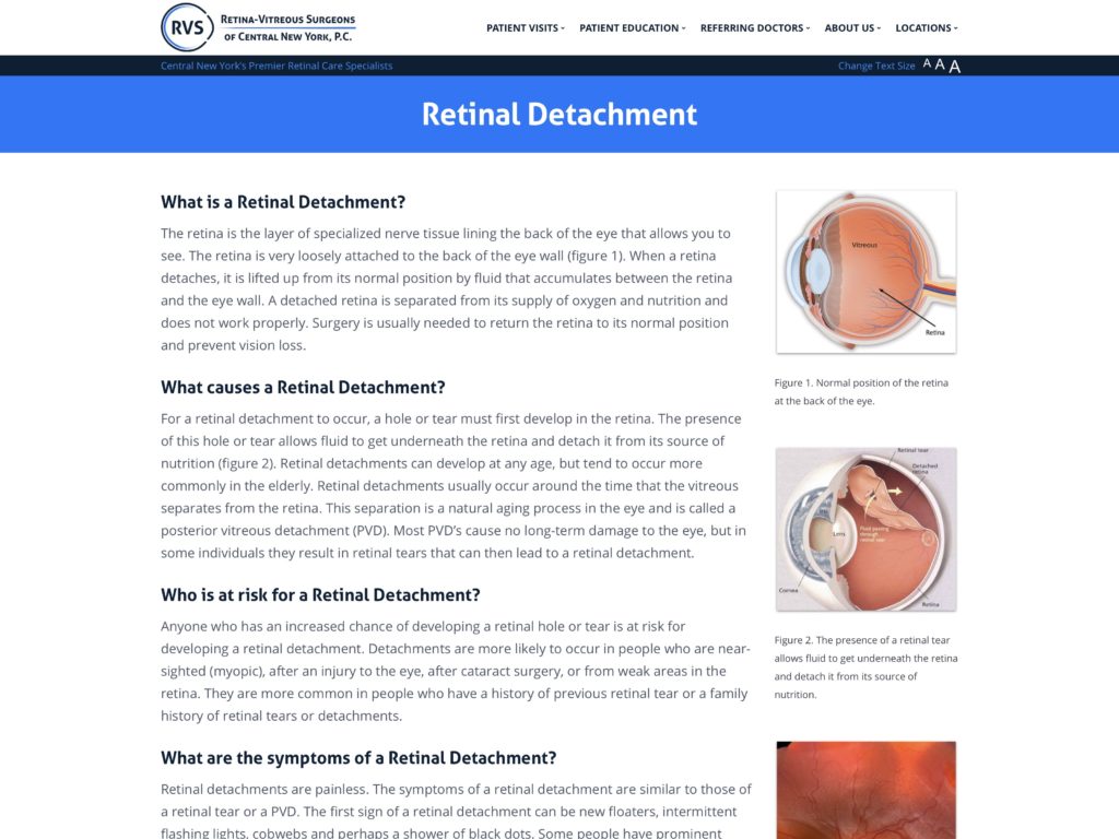 eye retina detachment operation eye retina detachment operation
