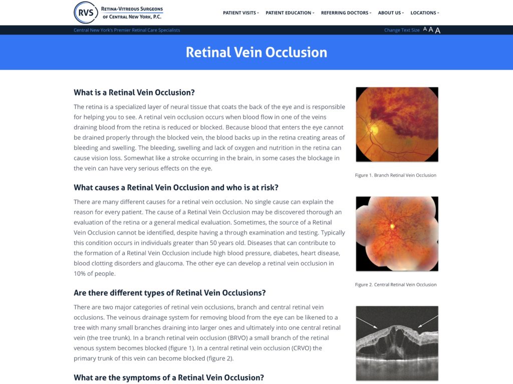 Retinal Vein Occlusion RetinaVitreous Surgeons of