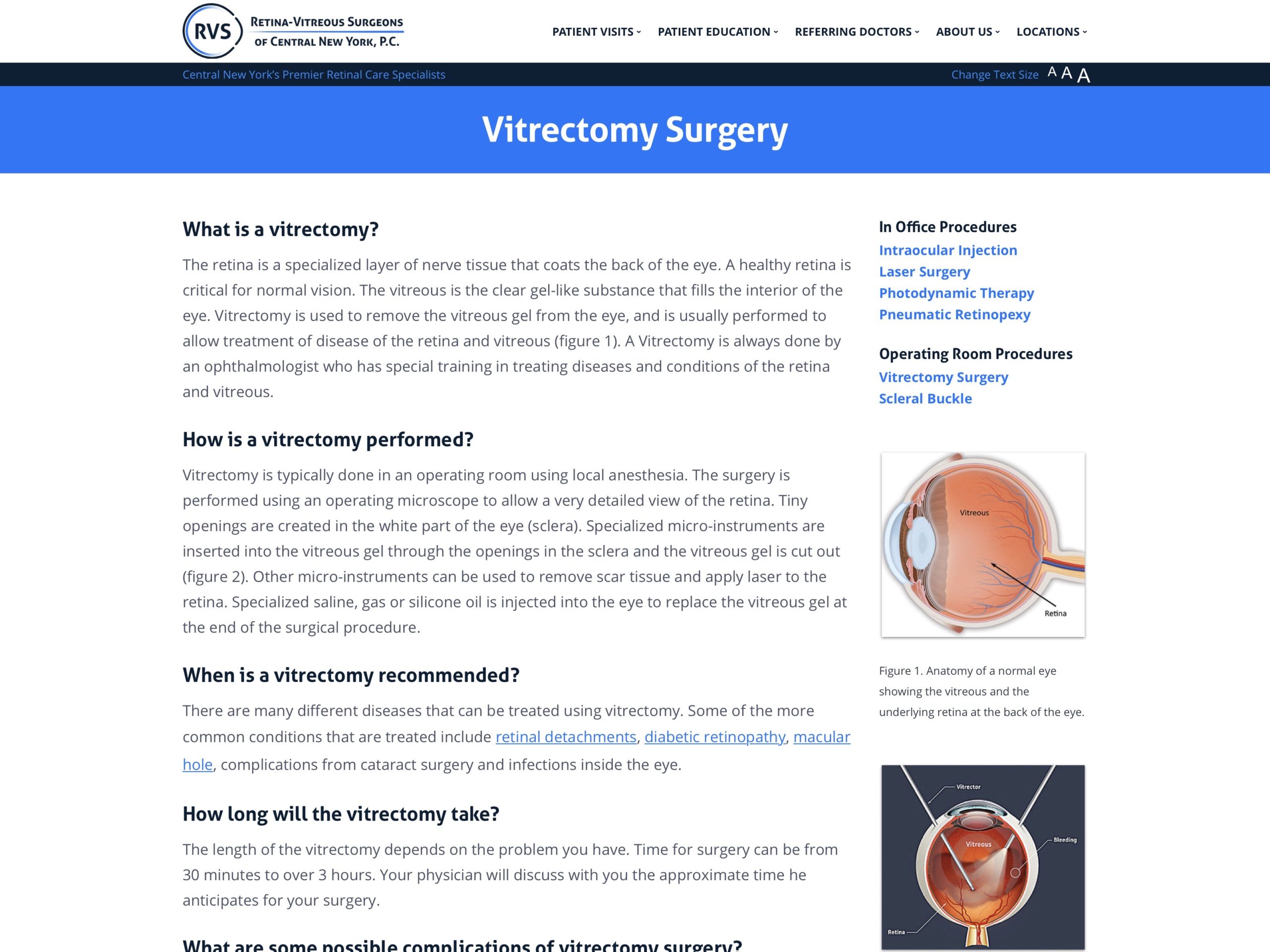 健康・医学 Vitreoretinal Surgery Strategies Tactics 51oJcegfaML._UF1000,1000_QL80_.jpg
